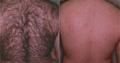 Male Back 1